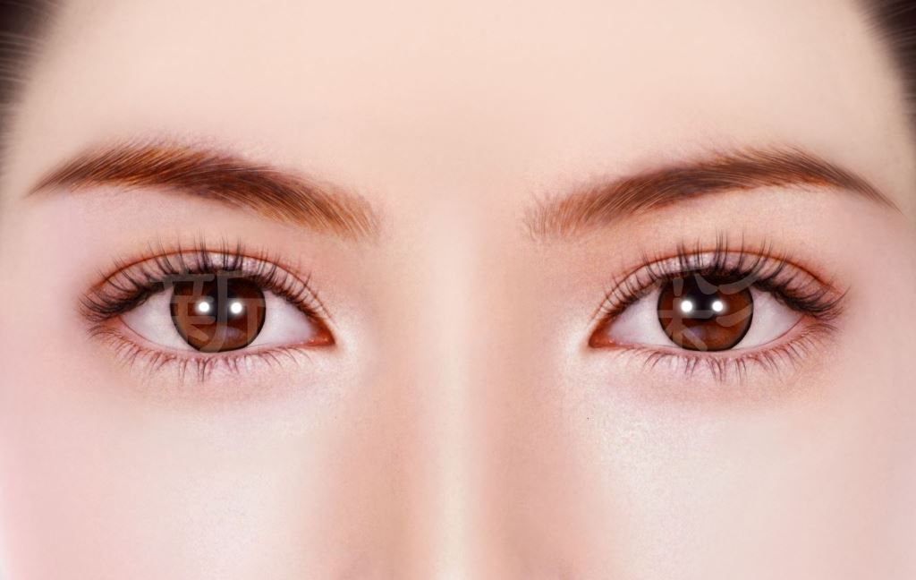 8字形隱痕縫雙眼皮：讓妳的雙眼皮更加美麗動人（新彩整型外科診所）值得信賴與推薦