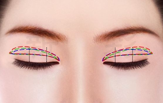 如何才能做出真正具有美感的雙眼皮，新彩整型外科診所縫雙眼皮值得您的信賴